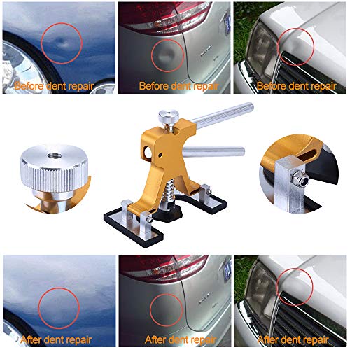 ARISD Auto Paintless Dent Repair Kits - Adjustable Gold Dent Lifter Dent Repair Tool Kit,Pops a Dent puller Kit for Car Hail Damage Repair and Car Dent Removal