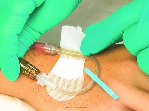 Grip-Lok Individually Packaged Medium Universal/1/8” - 5/16” (3.0 - 8.0mm)/3.5” (8.9 cm)/Box of 100