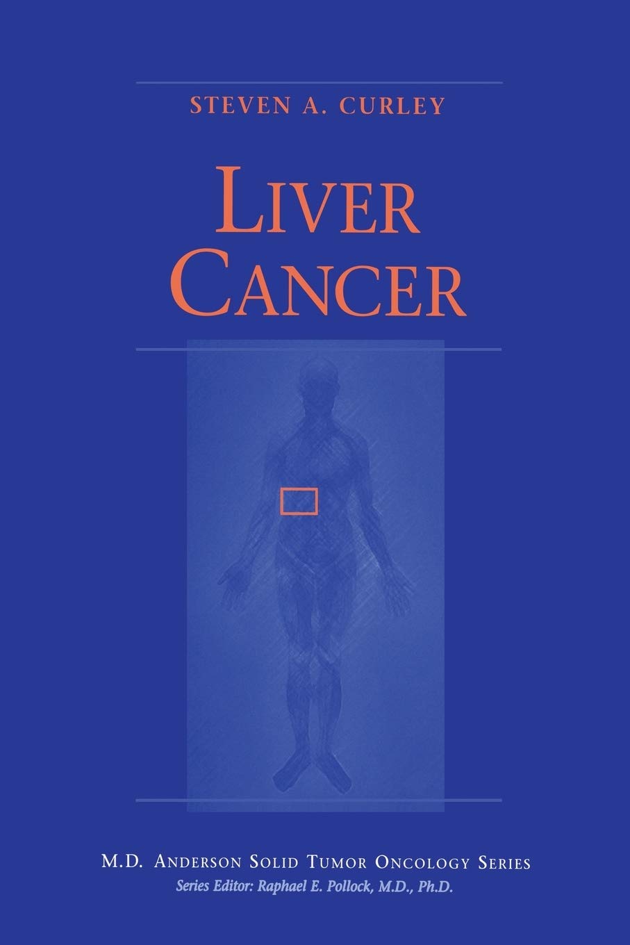 Liver Cancer (MD Anderson Solid Tumor Oncology Series)