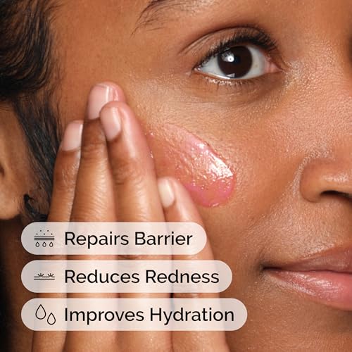 Image of The Ordinary Soothing & Barrier Support Serum, Redness-Reducing & Hydrating Solution for Skin Barrier Recovery, 30ml