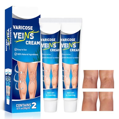 Varicose Veins Creme Krampfader Creme Verbessern Durchblutung Cre/me gegen Krampfadern Erleichtert die Ermüdung der Beine