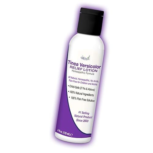 Naturasil Tinea Versicolor Loción de tratamiento a base de azufre, potente y rápido alivio antifúngico para la piel + picazón de pies, decoloración