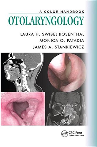 Buy Otolaryngology: A Color Handbook — BookShops.in