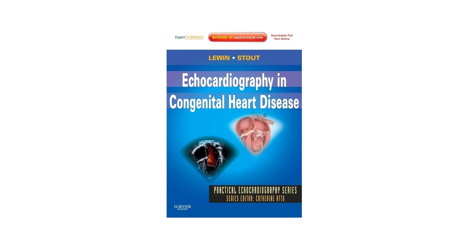 Echocardiography in Congenital Heart Disease: Expert Consult