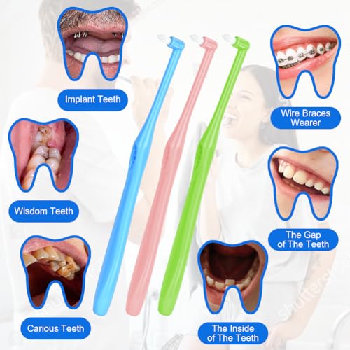 ACWOO Tuft Zahnbürste, 4 Stück Einbüschelbürste, Kleine Getuftet Bürste Weich Büschelzahnbürste Trimm Single Interdental Zwischenraum Bürste zur Detail Reinigung
