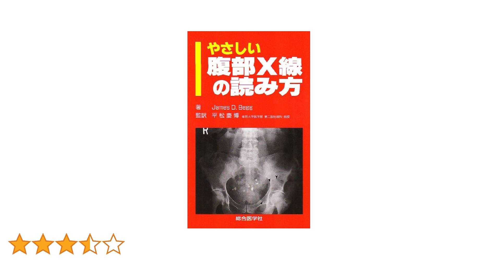 ココまで読める！実践腹部単純Ｘ線診断 「透視力」を鍛えて「臨床推論」能力を高める  第２版/中外医学社/西野徳之（単行本） ココまで読める！実践腹部単純X線診断 2版 | 西野 徳之 |本