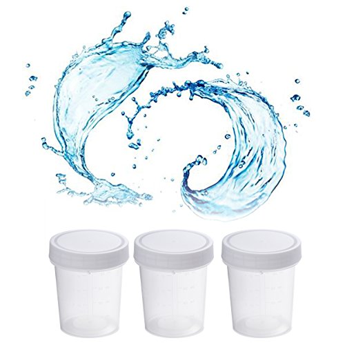 ULTECHNOVO Tazze da Collezione per Campioni di