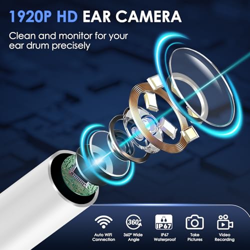 Xylla Ohrenschmalz Entferner Otoskop 1920P HD-Ear Wax Removal IP67 Wasserdicht WIFI Otoskop 360°Weitwinkel ohrreiniger mit 6 LEDs Tragbares Vergnügen der Ohrreinigungr (weiße)