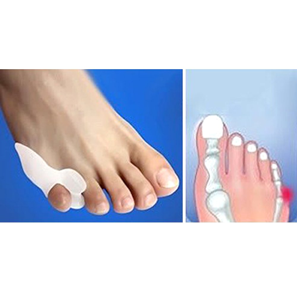 Tailor's Bunion Corrector and Gel Toe Separators for Pinky
