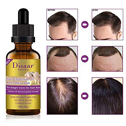 DISAAR BEAUTY Natural Hair Growth Serum Ginger Essential Oil Hair