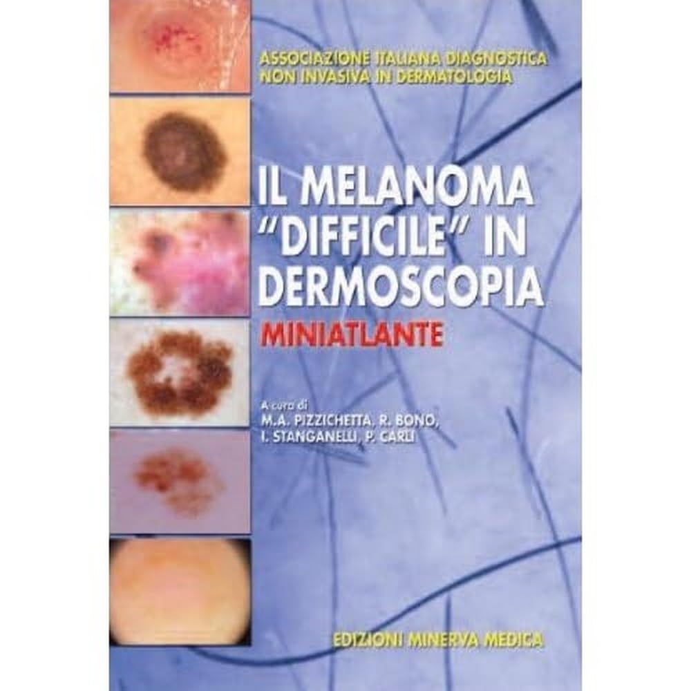Minerva Il Melanoma «Difficile» In Dermoscopia. Miniatlante - 4