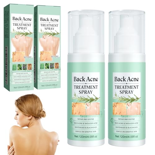 Akne Rücken Spray, 2 Stück Rücken Back Acne Spray, Gegen Pickel Rücken, Rücken-Peeling Tiefenreinigung, Akne-Behandlungsspray für Körper, Brust und Rücken, Behandlung von Rückenakne, Sanft zur Haut