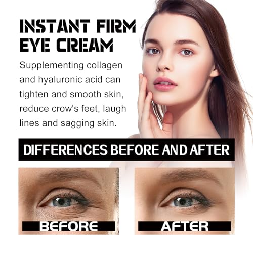 Instant Eye Tightener,Kaluofan 2PCS Eye Bag Cream,Reduce Eye Bags,Instant Firm Eye Tightener Eye Bag Cream For All Skin - Image 6