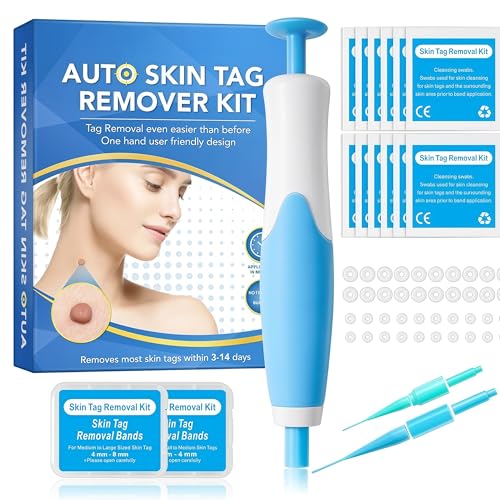 Eantas Alcura Complete Set BundlePräzisions-Hautanhängsel Entferner Schmerzfreie & Schnelle Behandlung Keine Narben Für Dauerhafte Ergebnisse Für Den Heimgebrauch (Blau)