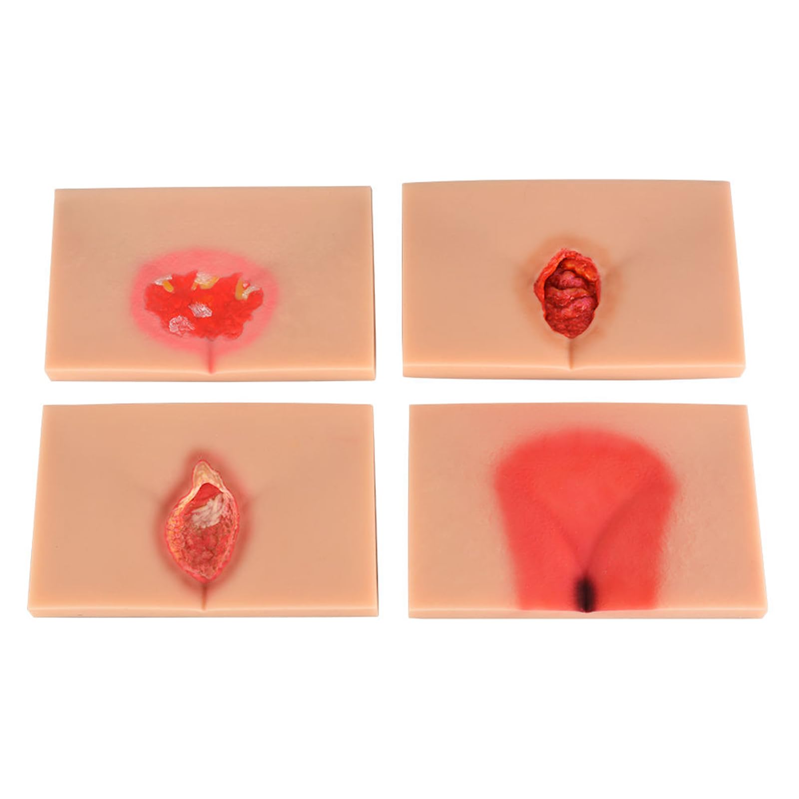 YRQMGSF 4 Stages Bedsores Model - Decubitus Ulcer Wound Care Model - Anatomical Model for Medical Science Training,Flesh,21CM