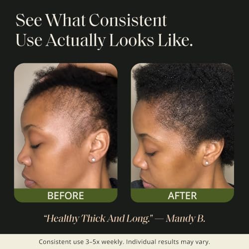 Glossed by Nae Voodoo Hair Growth Oil – Rosemary & Castor, 4oz — view 9