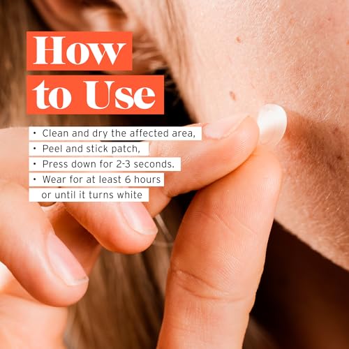 No BS Healing Acne Patches - Hydrocolloid, Acne Spot and Pimple Treatment to Prevent Acne Scars. Invisible On All Skin Tones (1 BOX of 36ct). Includes Free Skincare Samples