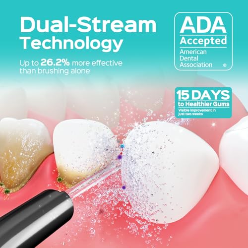Image of COSLUS ADA Accepted C50 Water Dental Flosser, 4 Modes 5 Intensity Levels