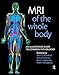 MRI of the Whole Body: An Illustrated Guide for Common Pathologies