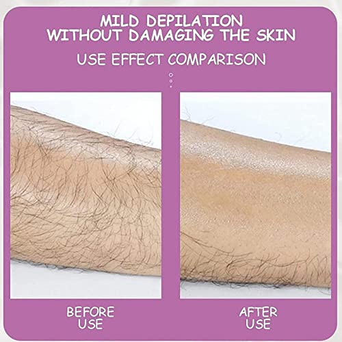 Hair Remover Legs Women's Crystal Hair Remover Smooth Skin Hair Removal Device Men Epilator Test Hair Removal Face Peach Fuzz Remover Disposable (B, One Size) #TOP3
