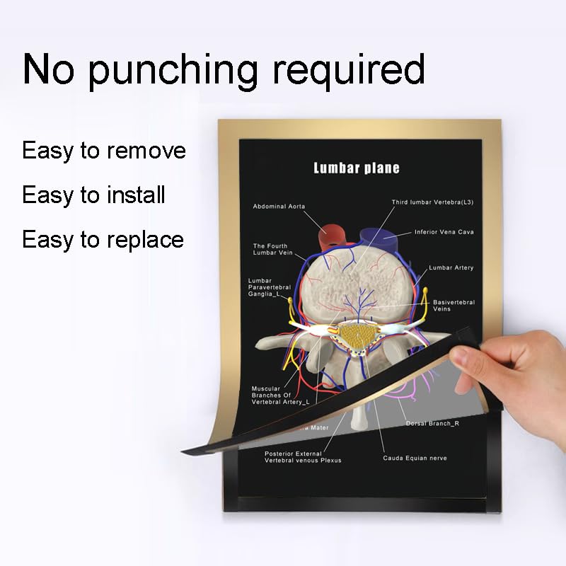 Image of Taanfu Body Educational Learning Anatomy Posters ，Lumbar Plane Art Lumbar Villi Anatomy Art Poster Digestive System Organs Illustration Small Intestine Physiology Anatomy Wall Art Villi