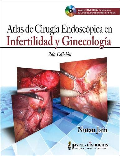Atlas de Cirugia Endoscopica en Infertilidad y Ginecologica / Atlas of Endoscopic Surgery in Inferti