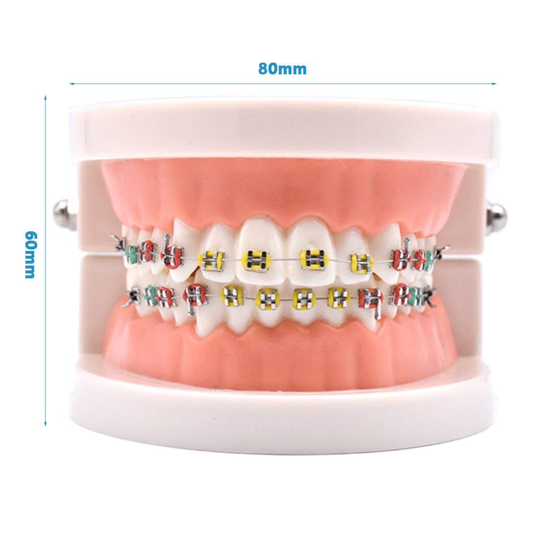 ERNZI Kieferorthopädische Zahnärztliche Behandlungsmodell Mit Keramischer Brackets, Kieferorthopädischer Metalldraht, Orale Kanalligatur, Verwendet Für Zahnärztliche Werkzeuge, Zahnärztliches Labor