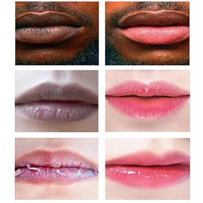 Lip Lightening Cream for Dark Lips | Lip Lightener for Smokers and Non-Smokers