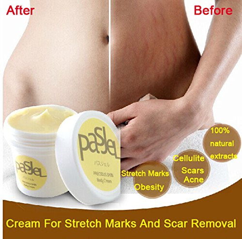 Pasjel Cream For Stretch Marks And Scar Buy Online In Qatar At Desertcart