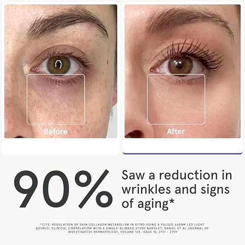 iRestore 3-Zone Red Light Therapy Set – Face, Eye, and Neck & Chest LED Masks for Targeted Skincare Across Delicate and Full Coverage Areas - Image 8