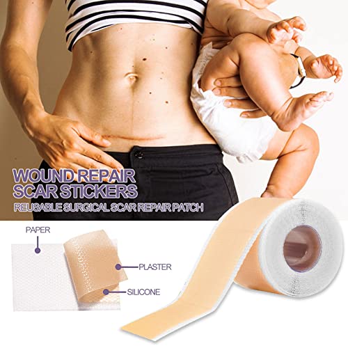 Narbenpflaster, Narbenpflaster Nach Op, Silikonpflaster für Narben, Silikon Narbenpflaster, Selbstklebende Narbenrolle… - Image 4