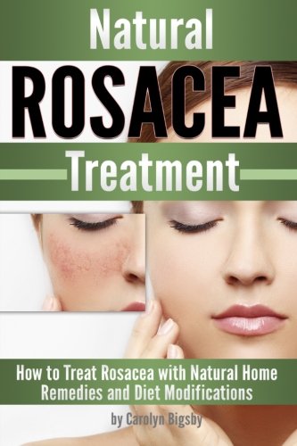 Natural Rosacea Treatment: How to Treat Rosacea with Natural Home Remedies and Diet Modifications