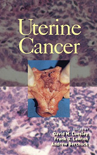 Uterine Cancer (English Edition) - Luesley, David M.