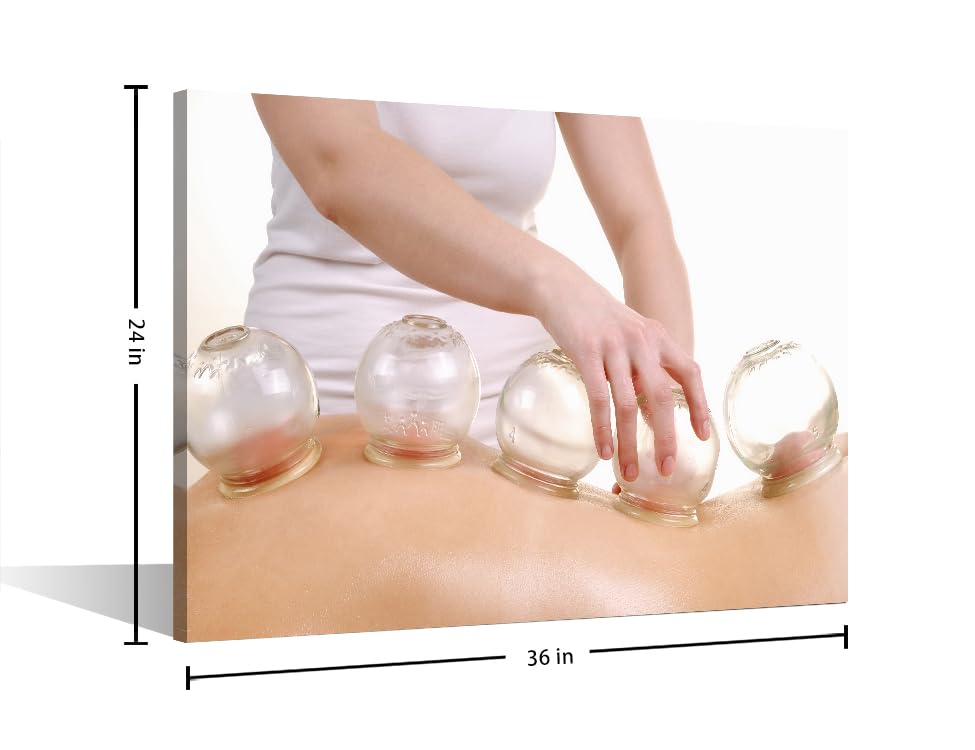 Image of Cupping Massage Wall Art Traditional Chinese Cupping Therapy Posters Wall Art for Living Nosocomium 1 Panels Art Prints Giclee Wooden Framed Gallery-Wrapped Ready to Hang (24 inch Wx36 H)