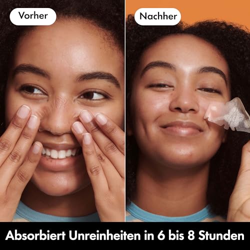 Hero Mighty Patch Nase, Hydrokolloid Pickelpflaster für die Nase, 10 Stück – Ansicht 4
