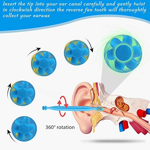 Ear Wax Removal Cleaner Tool Kit, FERNIDA 4 Types Earwax Remover Picks New Turbofan Structure Tech for Complete Ear Cleaning, Efficient Earsafe Design and Portable Storage Box Adults and Kids