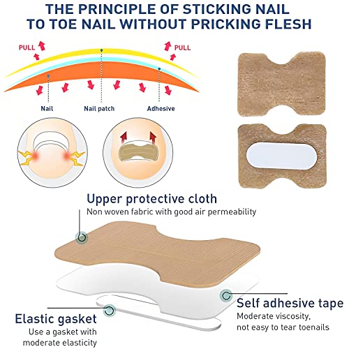 Treatment Ingrown Toenail Corrector Strips,Fitmedify Nail Patches with Nail Correction Tool Kit,Toenail Correction Patch,Ingrown Toenail Removal Kit - Image 5