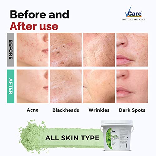 Image of Vcare Jelly Matcha Green Tea Peel Off Mask For Facials Skincare |Face Mask Powder 1kg - Facial Skin Care Product for Women Smoothing, Moisturizing, Cleansing, Refreshing