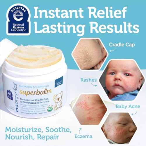 Image of Superbalm USDA Organic Healing Ointment for Baby Eczema & Cradle Cap - 8oz | 100% Natural Soothing Superfood Cream for Toddler & Kids - Eczema, Cradle Cap, Baby Acne & Rashes - Non-Toxic, Fragrance-Free