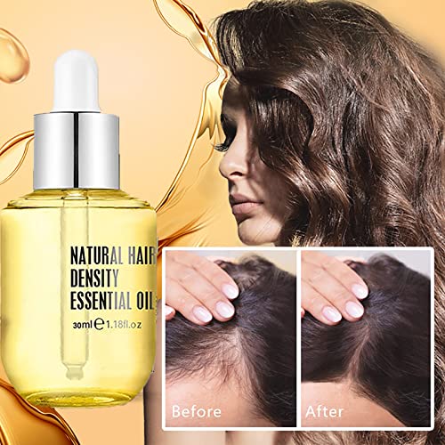 Pure-Natural-Hair-Density-Essential-Oil-Hovo-Hair-Density-Essential-Oil-Ginger-Essence-Hair-Growth-Oil-Hair-Regrowth-Essential-Oil-Natural-Hair-Regrowth-Serum-For-Women-Men-2PCS