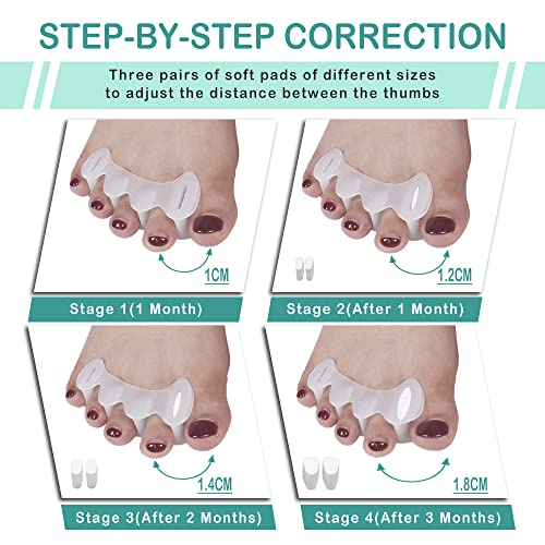 Cosysilk Correct Your Toes Adjustable Toe Spacers With Inserts Toe Separators For Women, For Plantar Fasciitis, Overlapping Toes, Feet Pain (S Size) #TOP1