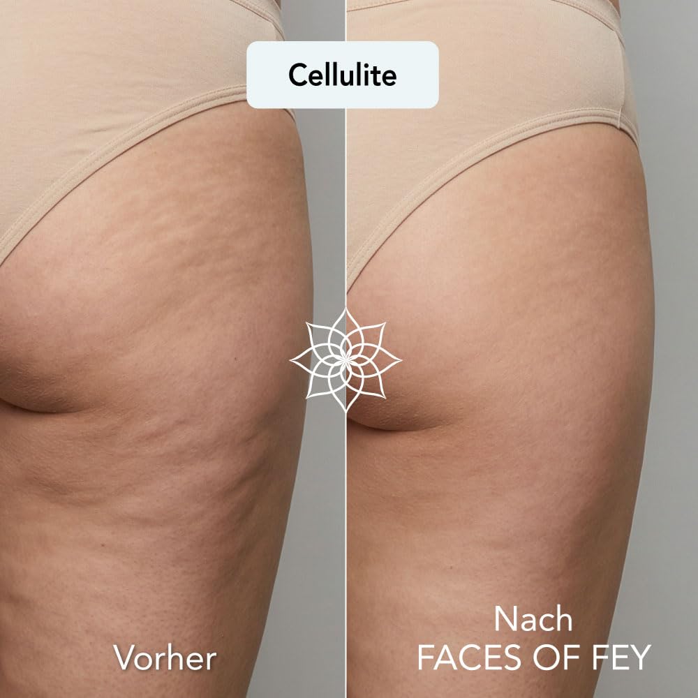 FACES OF FEY Derma roller – 192 prawdziwe igły – profesjonalny mikronakłuwanie do domu – wałek igłowy (zestaw hialuronowy 0,75 mm)