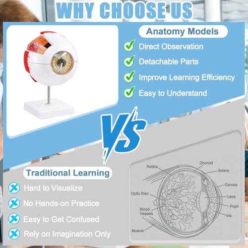 Image of Eye Anatomy Model, 6X Enlarged Eyeball Model, Human Eye Anatomical Model for Science Education Students Study Display Medical Teaching, with Removable Stand