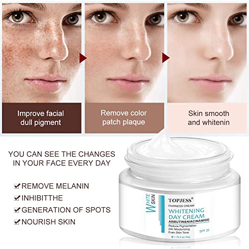Whitening-Creme Freckle Brightening Cream zur Hautaufhellung