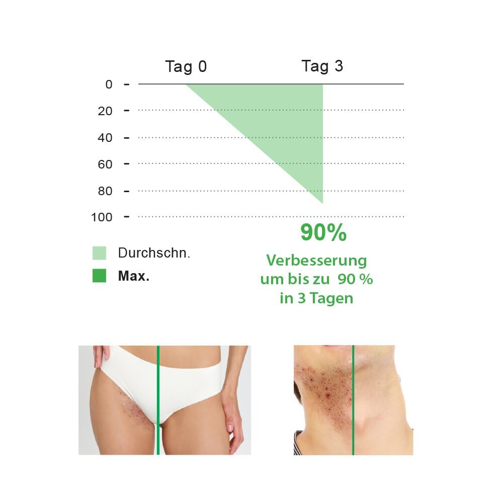 BioMD Przeciw wrastającym włoskom, z kwasami BHA i AHA, podrażnienia po goleniu, golenie, woskowanie, prevents ingrown hairs, Razor Burn, Shaving, Waxing, Vegan - 90ml