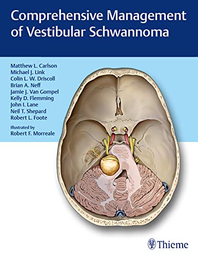 Comprehensive Management Of Vestibular Schwannoma Kindle Edition By Carlson Matthew L Carlson Matthew L Link Michael J Driscoll Colin L W Professional Technical Kindle Ebooks Amazon Com