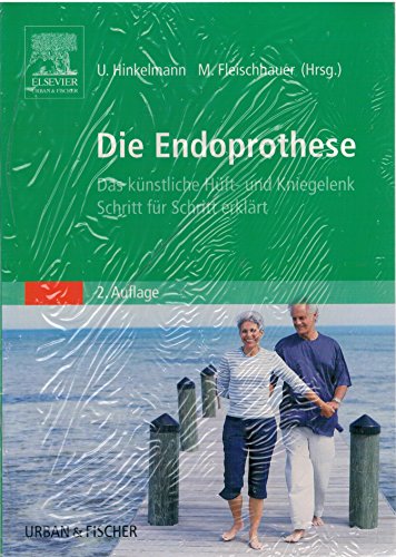 Die Endoprothese: Das künstliche Hüft- und Kniegelenk Schritt für Schritt erklärt