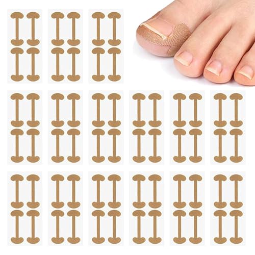 80 Stück Eingewachsene Zehennägel Set Zehennagel Korrektur Eingewachsener Zehennagel Nagelpflaster Patch für Behandeln Eingewachsener Zehnagel