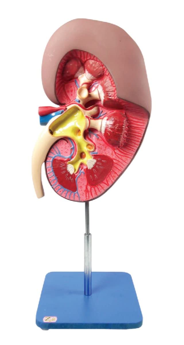 ZX | Kidney Model | HSP Resin | 31 features marked | Anatomical