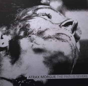 Pain Is Severe : Atrax Morgue: Amazon.es: CD y vinilos}